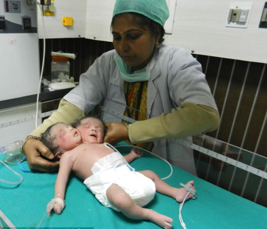 Baby-2 heads-1...
